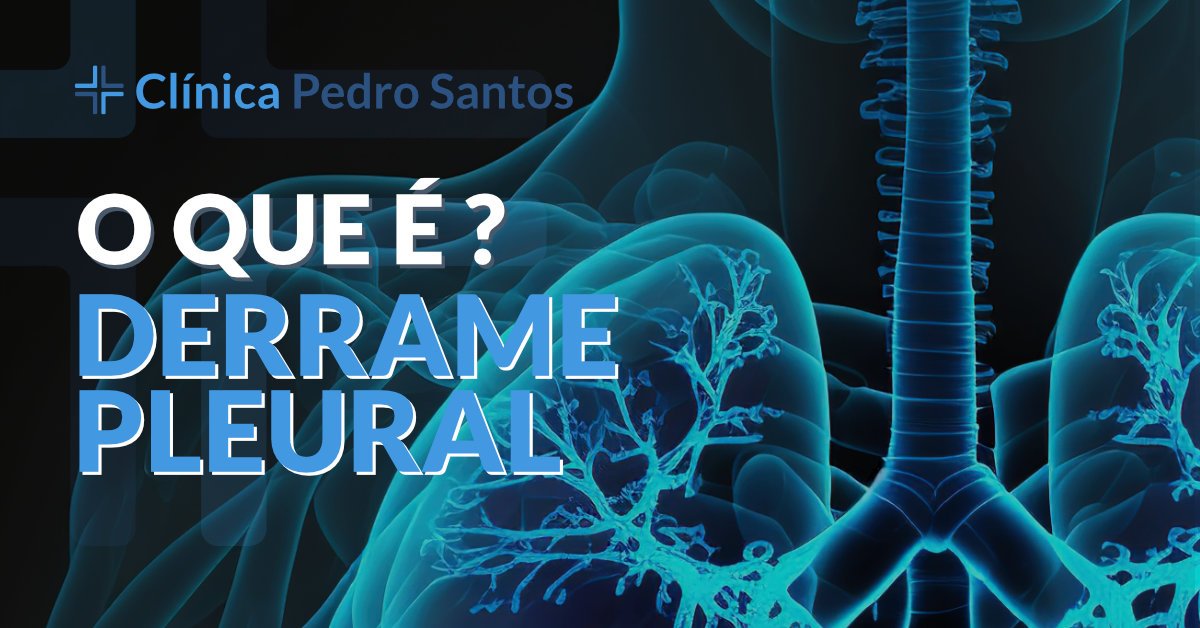O que é um derrame pleural?